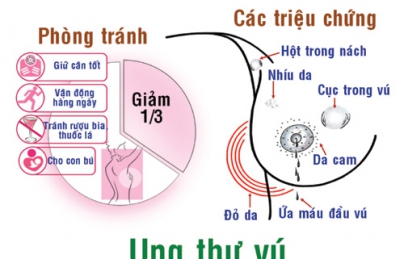 Người bị ung thư vú uống nấm lim xanh có được không?