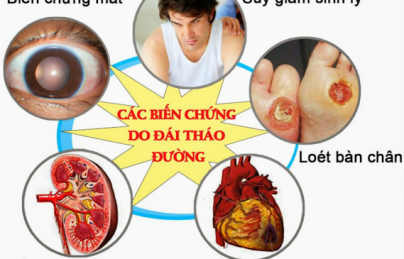 Nấm lim xanh chữa bệnh tiểu đường