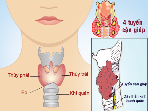 phát hiện và điều trị sớm ung thư tuyến giáp bằng nấm lim xanh